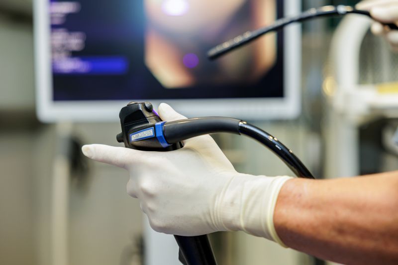 大腸内視鏡検査とは